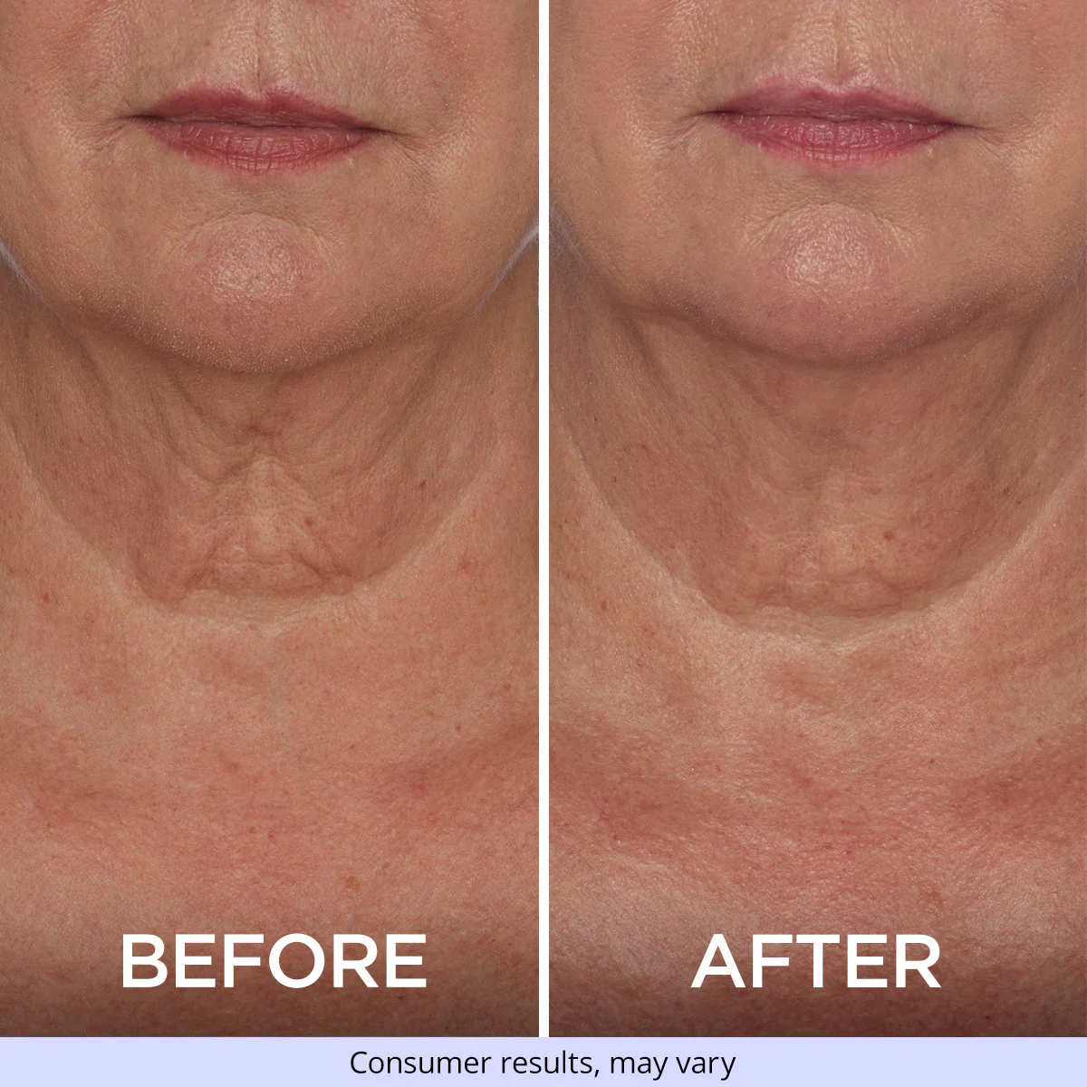 Tighten & Lift Neck Cream