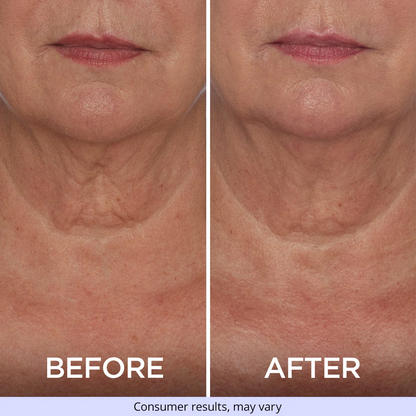 Tighten & Lift Neck Cream